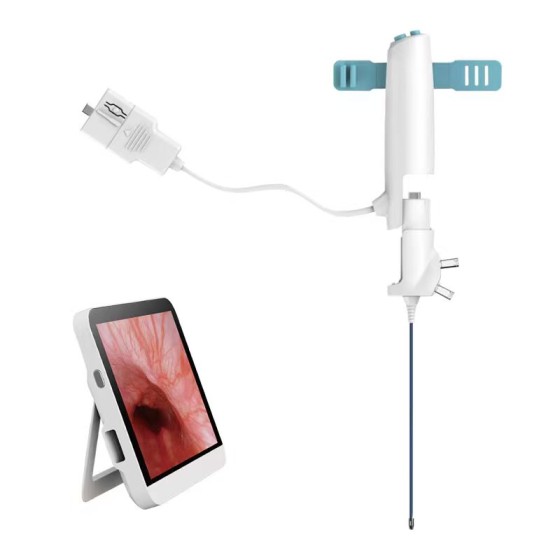 无创一次性电子内窥镜用于保胆结石取出